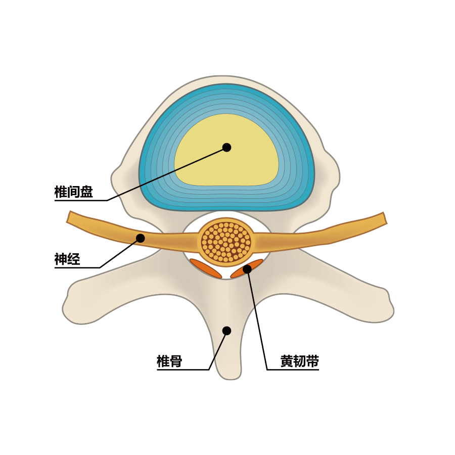 正常的椎间盘（側面図）